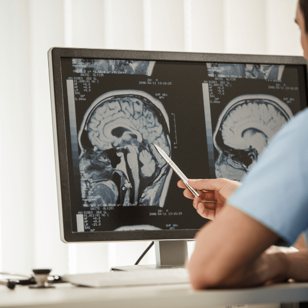 Neurochirurgia - emmebivigevano